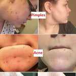 100% Natural Green Tea Deep Cleanse Mask
