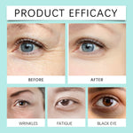 HOYGI Vitamin E Eye Cream Anti Aging Wrinkle Eye Serum Moisturizing Hydration Nourishing Reduce Dryness Firming Fade Fine Lines