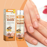 Bee Venom Nail Fungus Repair Spray Gray Nail Treatment Onychomycosis Paronychia Removal Relieve Foot Odor Hand Foot Nail Care