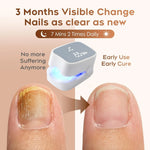 Effective Rechargeable Nail Fungus Remover Nail Fungus Cleaning Laser Device Repair Damaged Discolored Thick Fingernails
