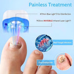 Effective Rechargeable Nail Fungus Remover Nail Fungus Cleaning Laser Device Repair Damaged Discolored Thick Fingernails