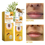 2× Tag Recede Bee Venom Treatment Spray Tag Recede for All Skin Bee Venom Spray