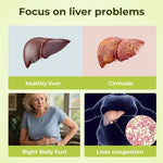 Milk Thistle Liver  Supplement – 300mg Silymarin – OXYENERGY – 90 Veg Capsu
